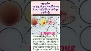 blood group | ABO Blood group #bloodgroup #girishchandra gi