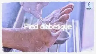 Le Pied Diabétique : Comprendre les Causes, Symptômes et Traitements avec le Professeur Heddame