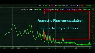 Stop ringing in ears immediately with Acoustic Tinnitus Retraining Therapy(TRT)