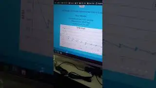 Speed √ Unstable Rate ☓ 