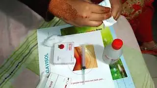 Buttock Injection Standing   Buttock injection Tutorial . Ep- 69
