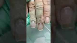 Квадрат БОРТИКАМИ 