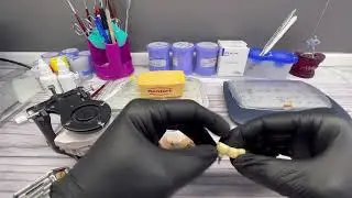 Цирконевый мостик на Имплантатах#стоматология#ярославль#зубы#dental