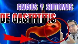 Causas  y síntomas de gastritis