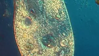 Protozoa in Extreme Detail, HD 1080p