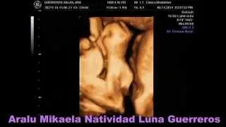 ARALU MIKAELA NATIVIDAD LUNA GUERREROS