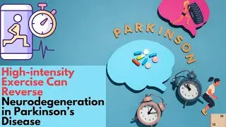High-intensity Exercise Can Reverse Neurodegeneration in Parkinson’s Disease