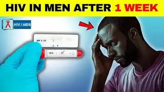 HIV Symptoms in Men After 1 Week