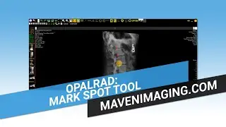 1 Mark Spot Tool