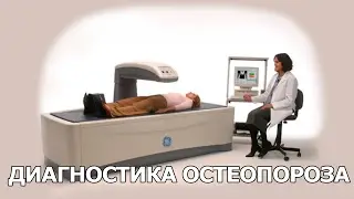Диагностика остеопороза