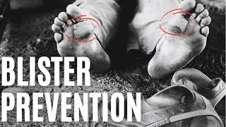 How I avoid blisters