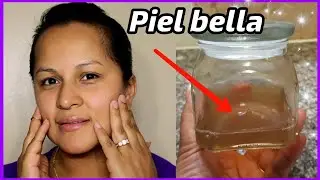 LA MEJOR AGUA PARA MANCHAS, ARRUGAS, ACNE Y OJERAS - Zara Martinez