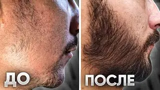 АЗИАТ ЗА 4 МЕСЯЦА ОТРАСТИЛ ШИКАРНУЮ БОРОДУ / Результаты mr.Volos