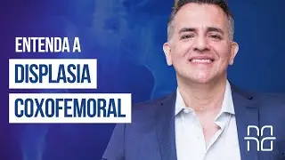 DISPLASIA COXOFEMORAL