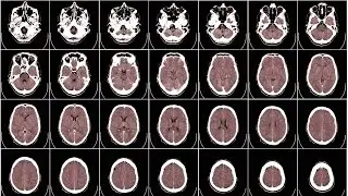 Mapping the Dynamic Brain