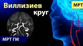 Step-by-step anatomy of the major arteries of the brain on MRI: Circle of Willis