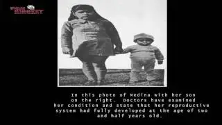 World's Youngest Mother, Age 5 Lina Medina