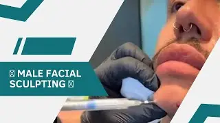 🗿 MALE FACIAL SCULPTING 💉