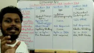 Difference between Southern blotting , Northern blotting and Western blotting