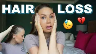 Lets chat about post partum hair loss/alopecia 💔 … I am losing my hair 😞Day(s) in our life vlog
