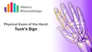 Rheumatology HAND exam: Tuck Sign for Extensor Tenosynovitis