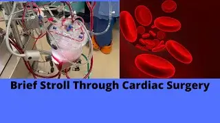 Brief Stroll Through Cardiac Surgery