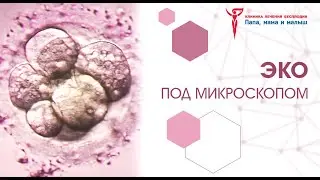 Как делают ЭКО?