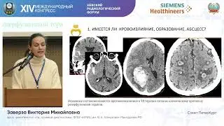 Диагностика ургентных состояний при цереброваскулярной патологии при поддержке Siemens Нealthineers