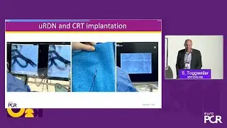 Ultrasound renal denervation is now guideline-recommended: how do I get started? - EuroPCR 2025