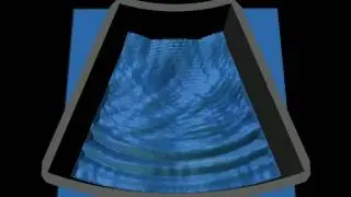 Spherical End-Plate Frustum Wave Simulation