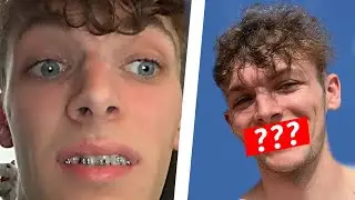 GETTING MY BRACES OFF *INSANE TRANSFORMATION*