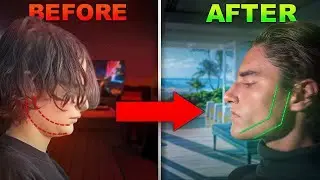 How To Fix Your Recessed Chin (Full Guide)