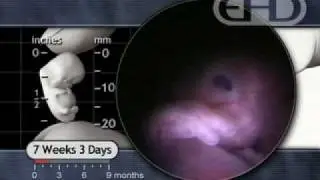 7 Weeks Pregnant -- Hiccups & Startle Response