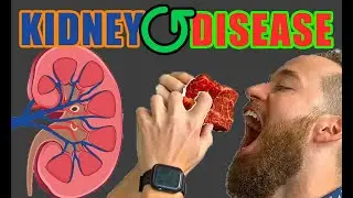 Can you reverse kidney disease? Keto Carnivore Diets Work!