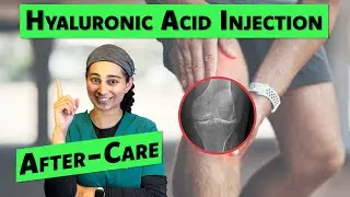 What To Do After Your Hyaluronic Acid (HA) Injection | DO NOT MISS