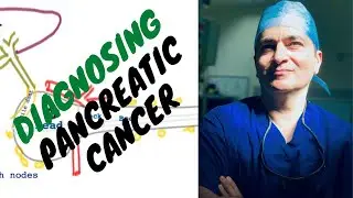 Pancreatic Cancer - Diagnosis (symptoms, signs, CT scan, biopsy, stent)