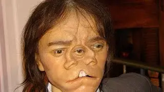 11 Real Life Freaks