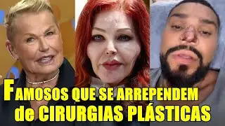 8 Celebrities Who Regret Plastic Surgery #3