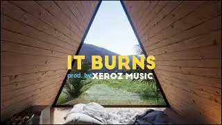 FREE REGGAETON MUSIC - [IT BURN'S]