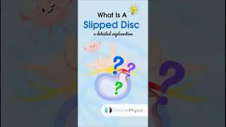 Slipped Disc Explained 