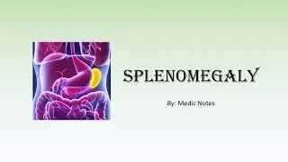Splenomegaly - causes, pathophysiology, differential diagnoses