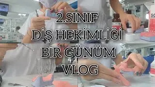 DİŞ HEKİMLİĞİ 2.SINIF BİR GÜNÜM VLOG - Protez kaşık yapımı