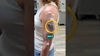 SHE WAS EMBARRASSED BY THIS BIRTHMARK! ❤️‍🩹
