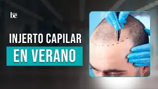 ¿Es recomendable realizarse el INJERTO CAPILAR en verano?