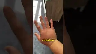 JE DOIS ALLER À L'HÔPITAL VOUS PENSEZ ???
