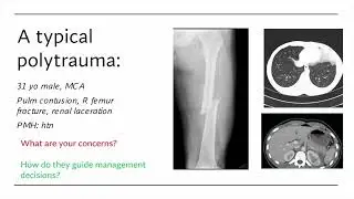 VTE Prevention in ortho trauma: Is it time for aspirin?