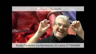 Nomenclatura implantare e innervazione naso interno #anestesia #scollamentomucosanasale
