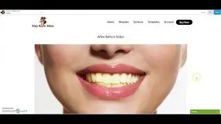 Ninja Beaver Addons  Before After Slider Module