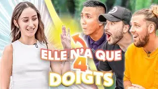 Ces gens ont des particularités physiques improbables
