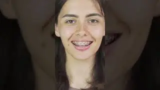 Ața dentară | De ce insistăm să facă parte din rutina de igienă dentară | Dr. Cristina Munteanu